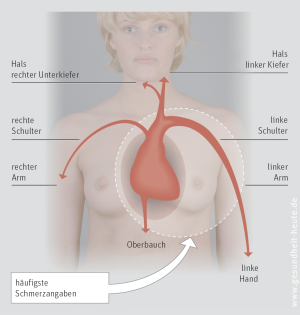 Koronare Herzkrankheit (KHK) und stabile Angina pectoris