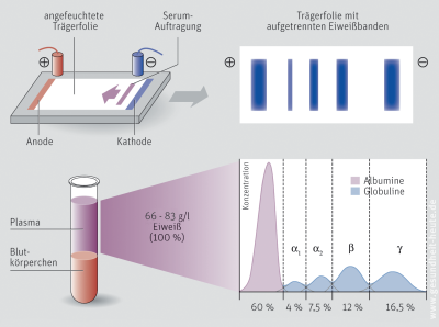 Eiweißelektrophorese (Elektrophorese)